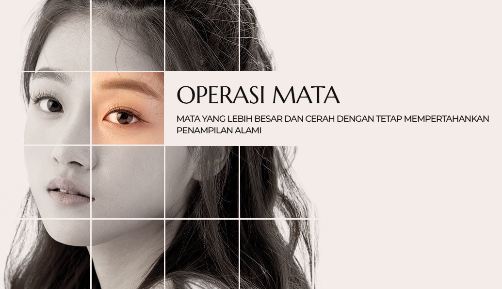 Hasil Operasi Mata