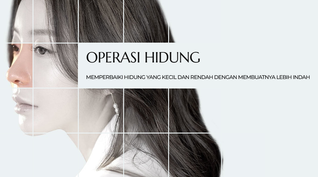 Hasil Operasi Hidung