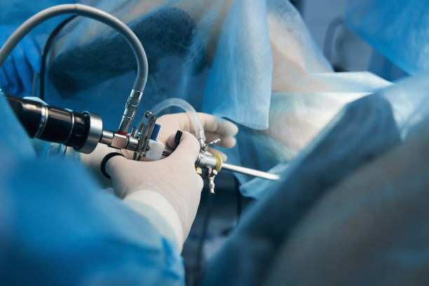 endoscopy